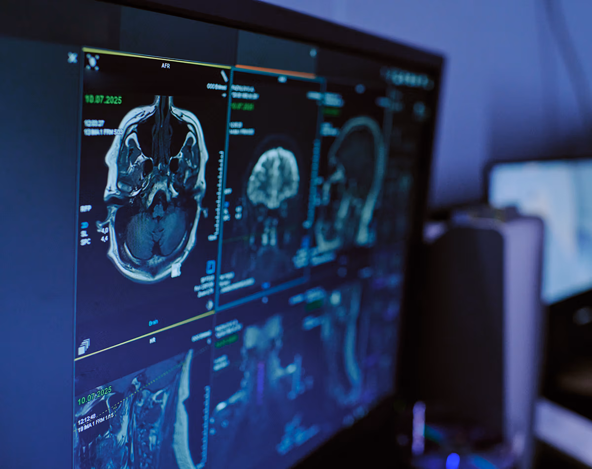 MRI brain scans displayed on a monitor in a medical imaging lab